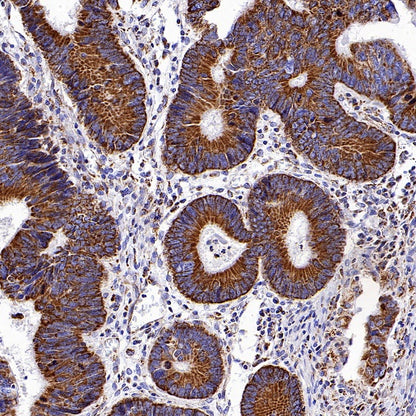 UQCRC2 Recombinant Rabbit mAb (S-1890-227)