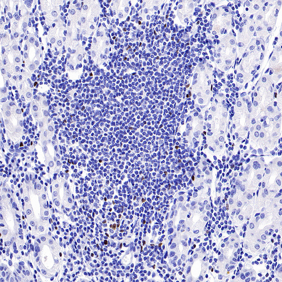 S-RMab® FOXP3 Recombinant Mouse mAb,PBS Only (SDT-R149)