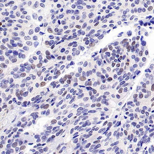 CDK6 Recombinant Rabbit mAb (S-1312-23)