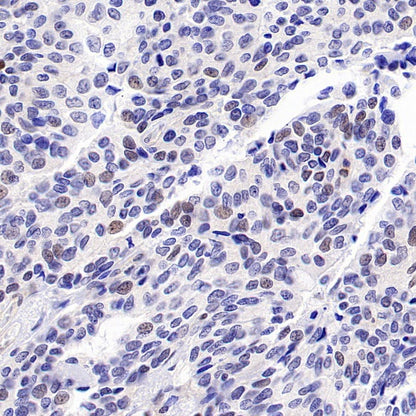 CDK6 Recombinant Rabbit mAb (S-1312-23)