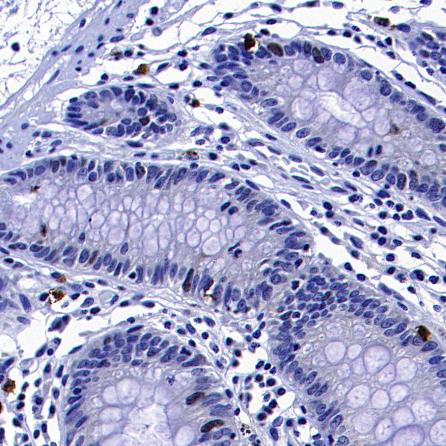 CENP-F Recombinant Rabbit mAb (S-3148-75)