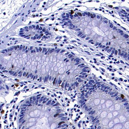CENP-F Recombinant Rabbit mAb (S-3148-75)
