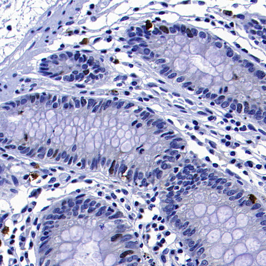 CENP-F Recombinant Rabbit mAb (S-3148-75)