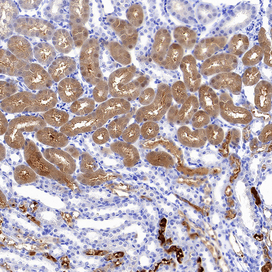 Aass Recombinant Rabbit mAb (S-4170-22)