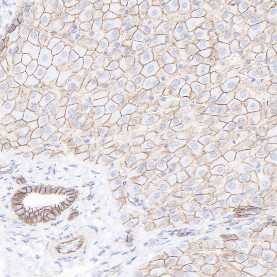 β-Catenin Recombinant Rabbit mAb,PBS Only (SDT-336-23)