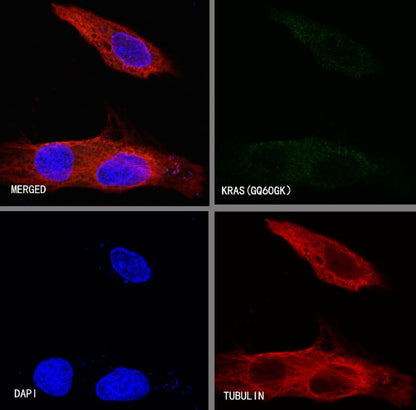 KRAS (mutated GQ60GK) + (mutated Q61K) Recombinant Rabbit mAb (S-604-4)