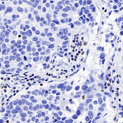 IKAROS Recombinant Rabbit mAb (S-729-146)