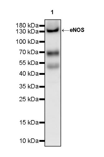 eNOS Recombinant Rabbit mAb (S-1885-94)