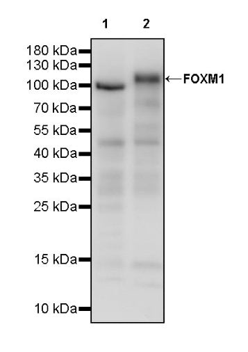 FOXM1 Recombinant Rabbit mAb (S-2529-26)