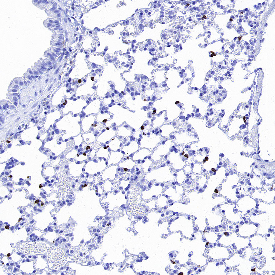 MMP9 Recombinant Rabbit mAb (S-3915-36)
