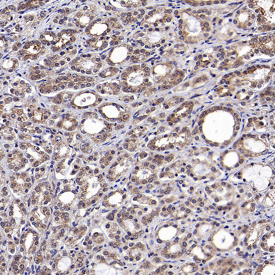 WSB1 Recombinant Rabbit mAb (S-3505-23)