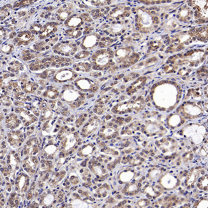 WSB1 Recombinant Rabbit mAb (S-3505-23)