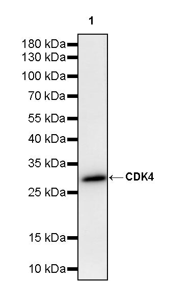 CDK4 Rabbit Polyclonal Antibody