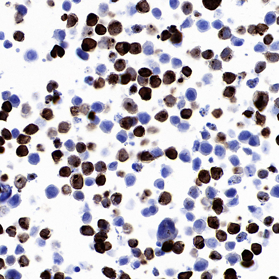 STEAP1+STEAP1B1+STEAP1B2 Recombinant Rabbit mAb (S-3226-137)