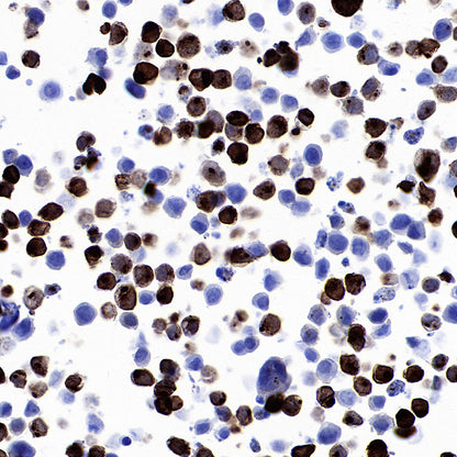 STEAP1+STEAP1B1+STEAP1B2 Recombinant Rabbit mAb (S-3226-137)