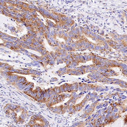 M6PR Recombinant Rabbit mAb (S-2348-14)