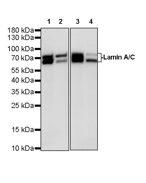 Lamin A/C Recombinant Rabbit mAb (S-5671)