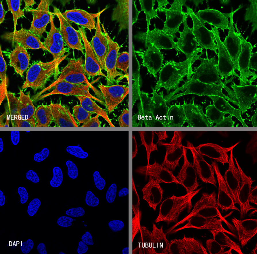 Beta Actin Recombinant Mouse mAb (S-5033)