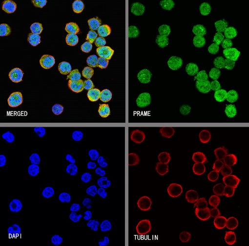 PRAME Recombinant Rabbit mAb (S-1876-173)