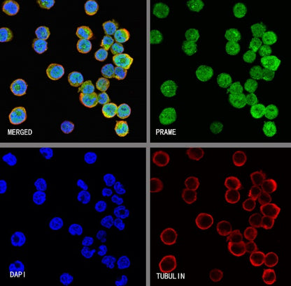 PRAME Recombinant Rabbit mAb (S-1876-173)