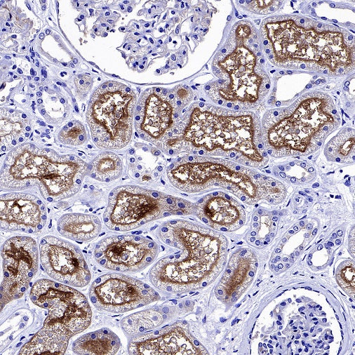 Angiotensin Converting Enzyme 1 Recombinant Rabbit mAb (SDT-2662-122)