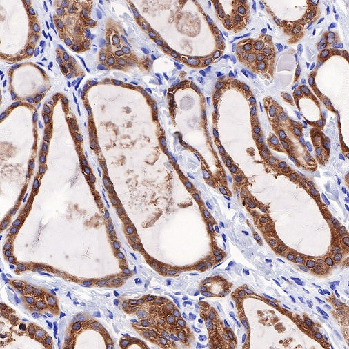 TPO Recombinant Rabbit mAb (SDT-420-57-1)