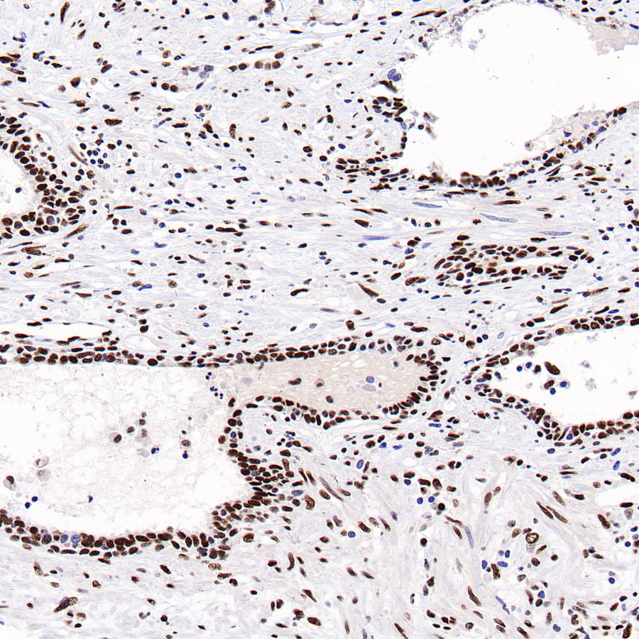 PML Recombinant Rabbit mAb (S-1908-60)