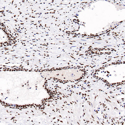 PML Recombinant Rabbit mAb (S-1908-60)