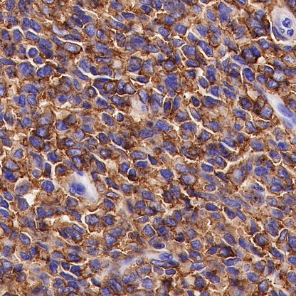 CD99 Recombinant Rabbit mAb (SDT-R122)