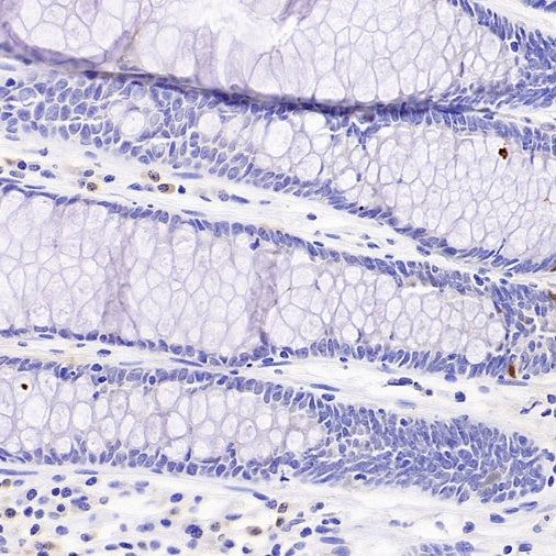 CDKN2A/p16 INK4A Recombinant Mouse mAb (SDT-4677)