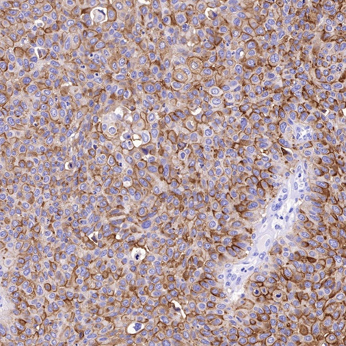 LYPD3/C4.4A Recombinant Rabbit mAb (S-R222)