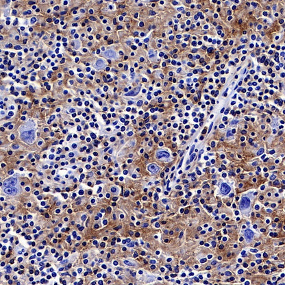 LAIR1 Recombinant Rabbit mAb (S-285-2)