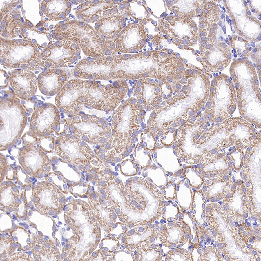 TOM20 Recombinant Rabbit mAb (S-M0015)