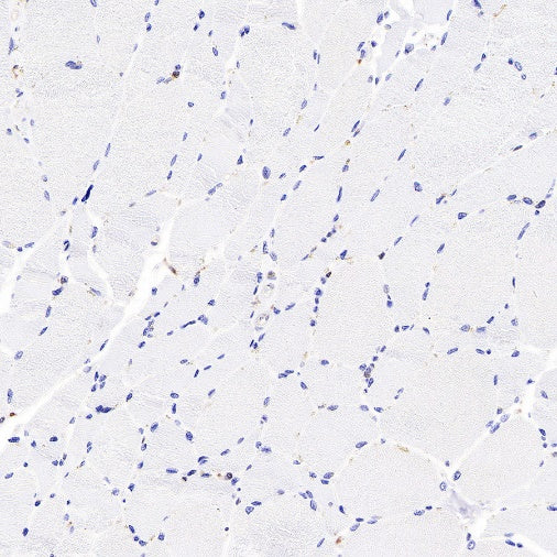 IDH1 Recombinant Rabbit mAb (S-792-16)
