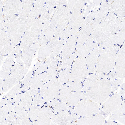 IDH1 Recombinant Rabbit mAb (S-792-16)