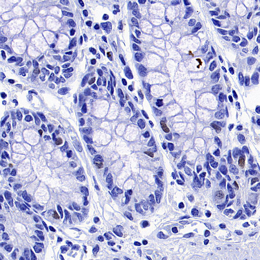 NeuroD1 Recombinant Rabbit mAb (SDT-3843-59)