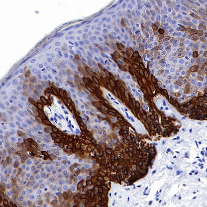 Keratin 16 Recombinant Rabbit mAb (S-R306)