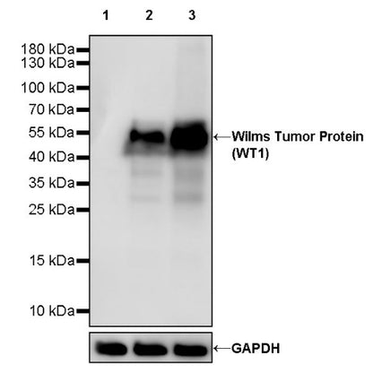 Wilms Tumor Protein (WT1) Recombinant Rabbit mAb (SDT-2864)