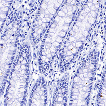MAGE-A4 Recombinant Rabbit mAb (S-3868-66)
