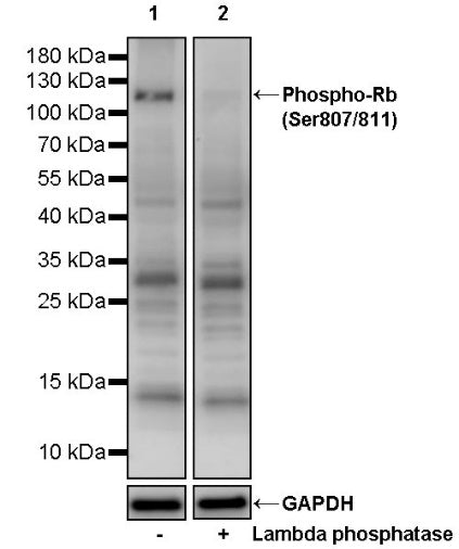 Phospho-Rb (Ser807/811) Recombinant Rabbit mAb (S-2215-52)