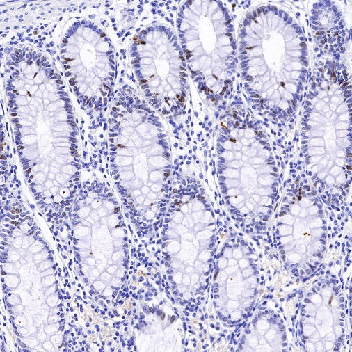 Topoisomerase II alpha Recombinant Rabbit mAb (S-513-7)