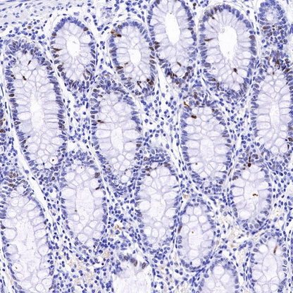 Topoisomerase II alpha Recombinant Rabbit mAb (S-513-7)