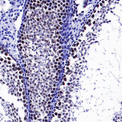 CoREST Recombinant Rabbit mAb (S-4401-8)