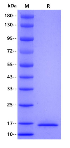Human Cystatin C protein, His tag