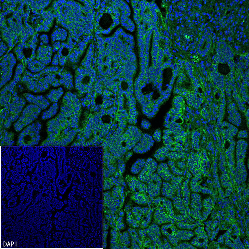 CD151 Recombinant Rabbit mAb (S-3235-104)