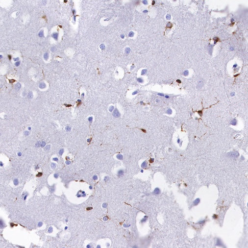 Alpha B Crystallin Recombinant Rabbit mAb (S-R216)