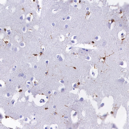 Alpha B Crystallin Recombinant Rabbit mAb (S-R216)