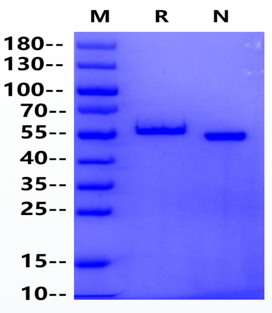 ITK (352-620) GST&His Tag Protein, Human