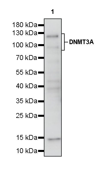 DNMT3A Recombinant Rabbit mAb (S-4120-54)