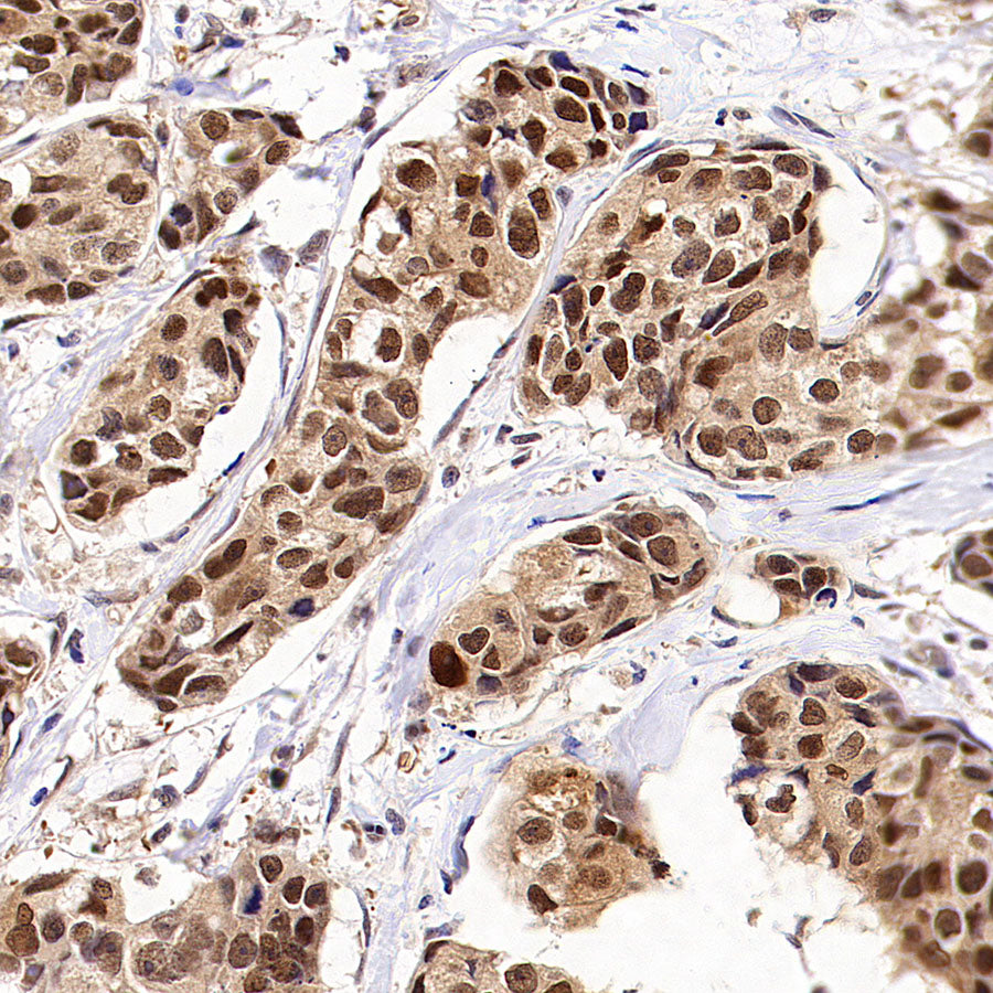 USP5 Rabbit Polyclonal Antibody